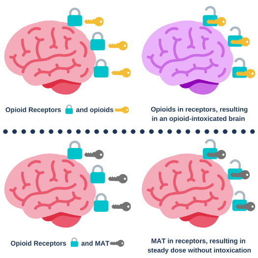 picture of opioids impact on the brain