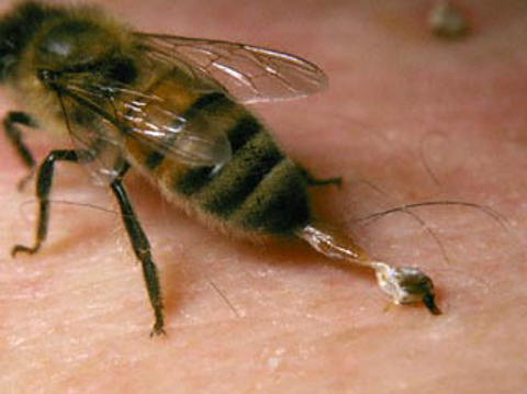 Fig. 5. Honey bees have a barbed sting and die shortly after stinging mammals.