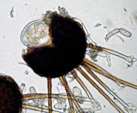 A chasmothecium erupting to release ascospores