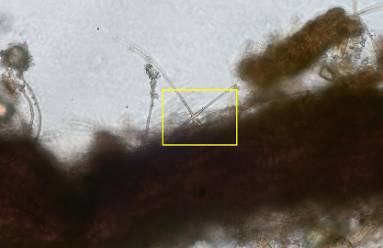 Cruciform hyphae as seen under a microscope.
