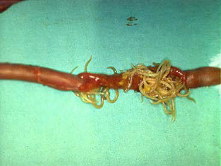 Opened chicken intestine with a tangled mass of pale yellow roundworms spilling out.