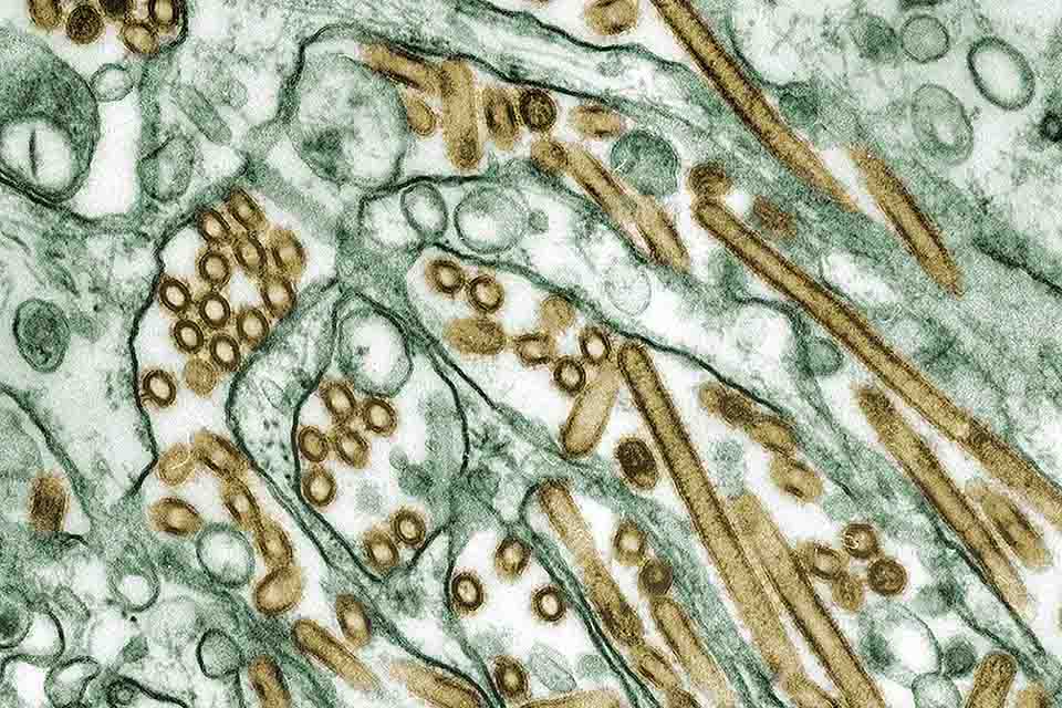 H5N1 bird flu viruses growing inside cells, seen under a microscope.