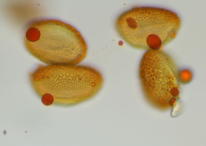 Magnified pollen grains under a microscope
