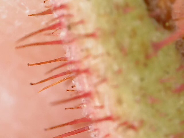 Microscope image of a raspberry stem.
