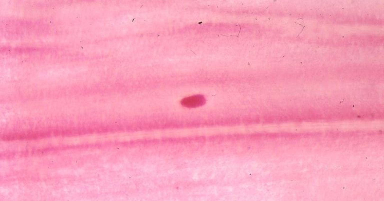 Stained Thrips Egg